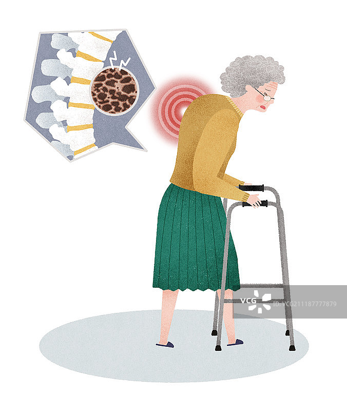 祖母，老人，骨质疏松症，疼痛，疾病，保健图片素材