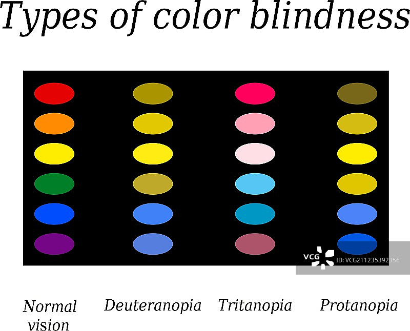 色盲的类型眼睛的颜色感知图片素材