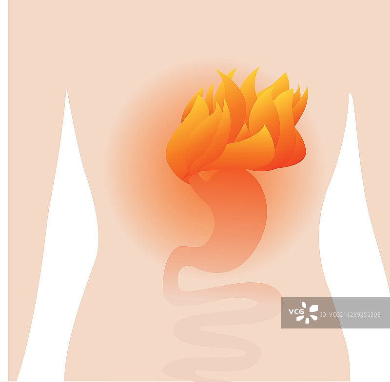 胃炎的胃疼痛图片素材