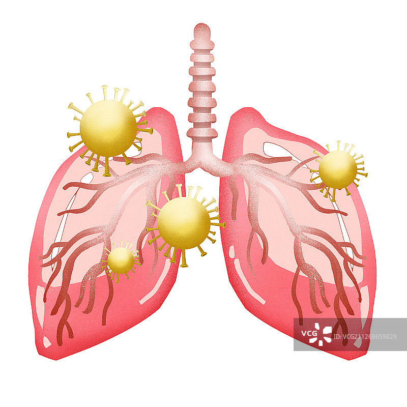 传染病肺炎肺部插画图片素材