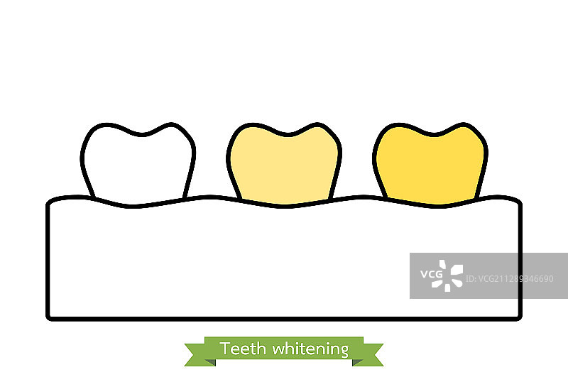 白到黄的牙齿-美白牙齿的概念图片素材