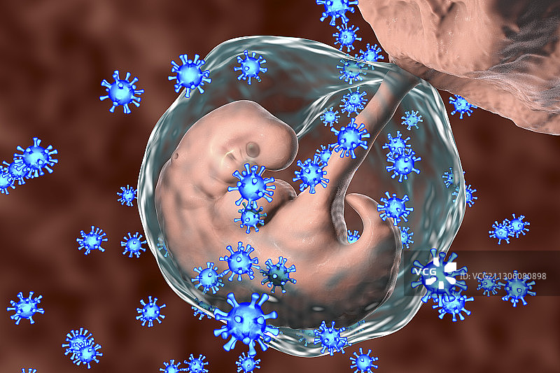 病毒感染人类胚胎，概念说明图片素材