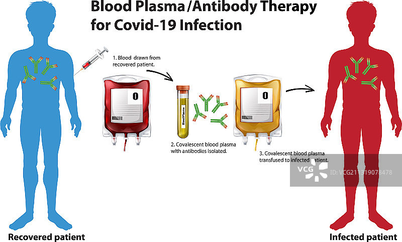 COVID-19血浆抗体治疗图片素材