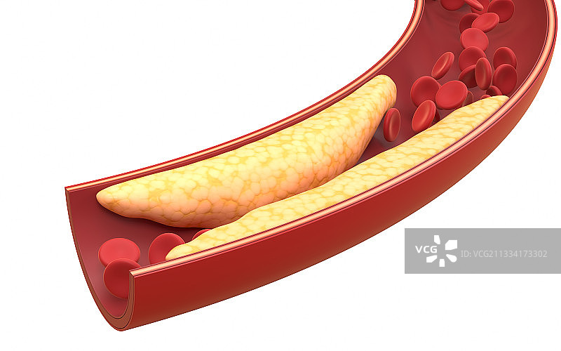 血管中的脂肪与红细胞 3D渲染图片素材