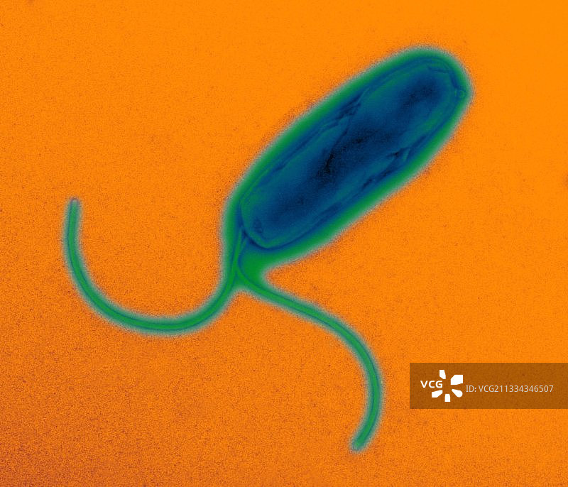 幽门螺杆菌，TEM图片素材