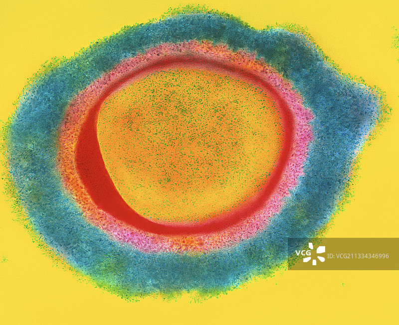 细菌耐药葡萄球菌图片素材