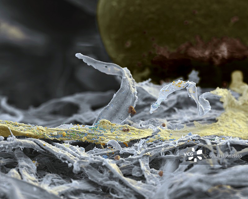 黏菌痕迹，扫描电镜图片素材