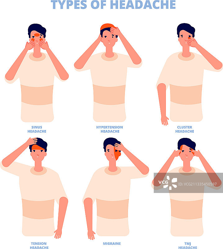 头痛类型不同，发病神经区域不同图片素材