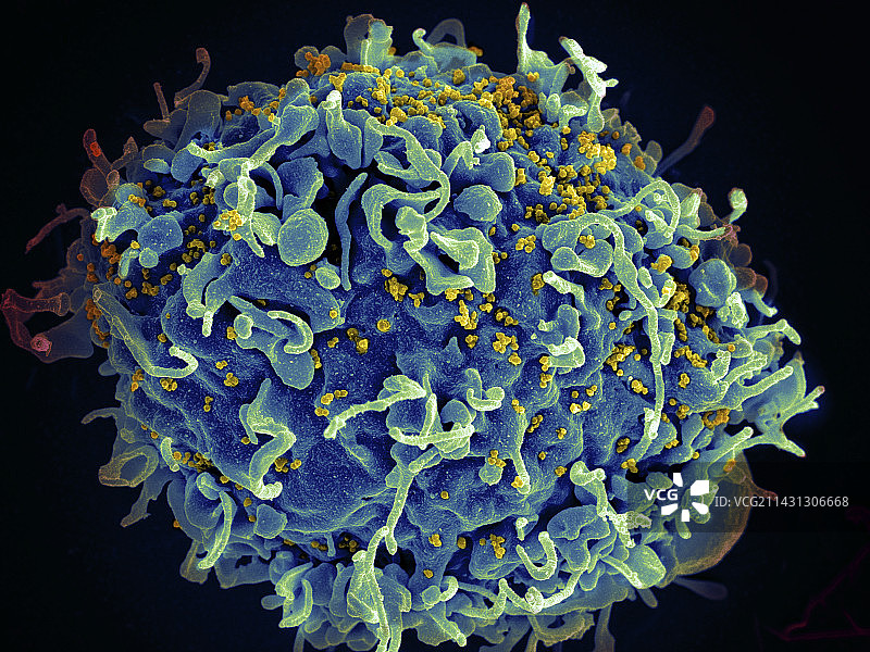 被HIV攻击的T细胞，SEM图片素材