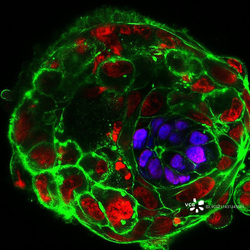 10天人类胚胎，荧光显微照片图片素材