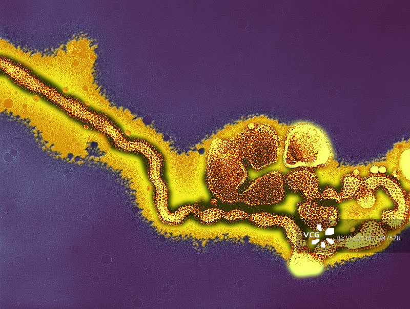 丙型流感病毒TEM图片素材