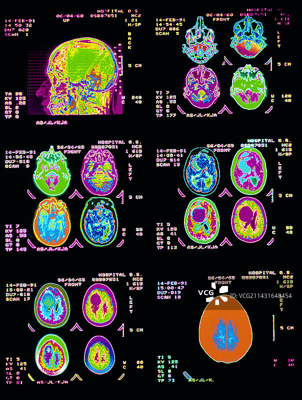 大脑彩色CT扫描图图片素材