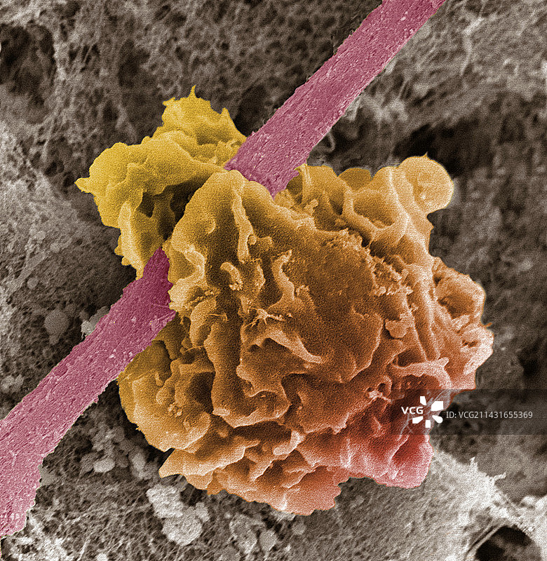 巨噬细胞摄取碎片，SEM图片素材