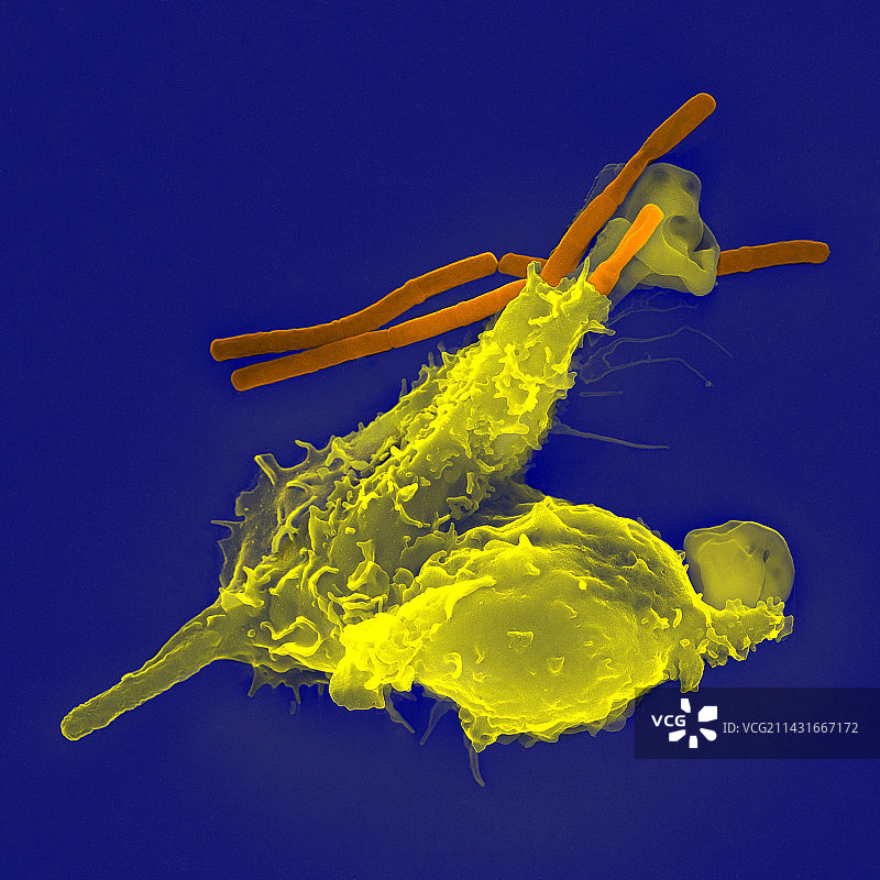 中性粒细胞和炭疽菌，扫描电镜图片素材