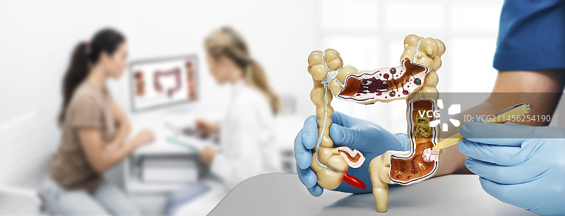 肠道疾病，合成图像图片素材