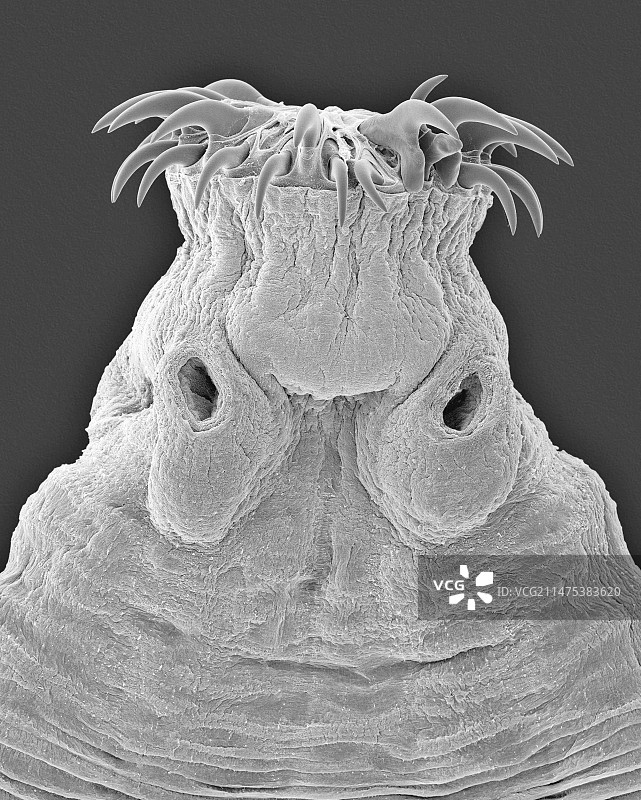 哺乳动物肠绦虫(带绦虫属)，SEM图片素材