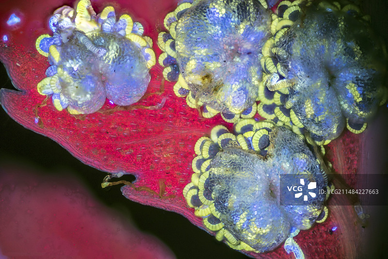 树蕨孢子，光镜照片图片素材