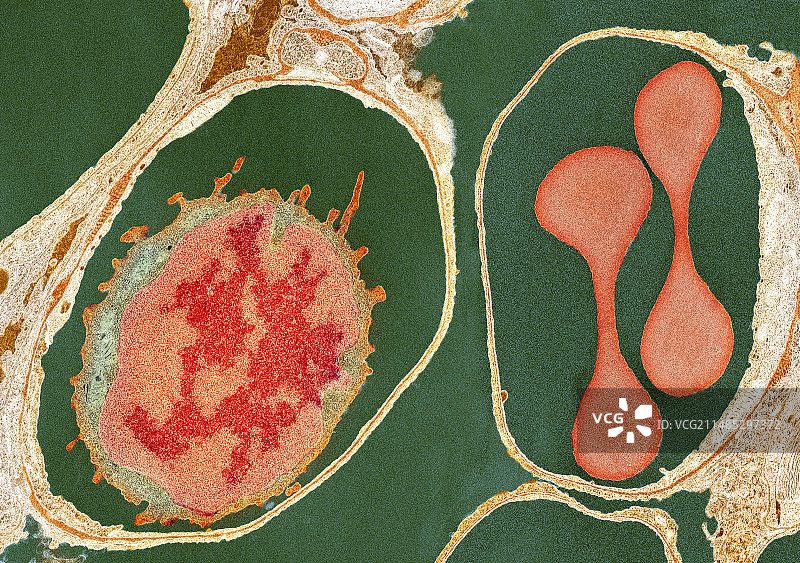 肺泡和血细胞，TEM图片素材