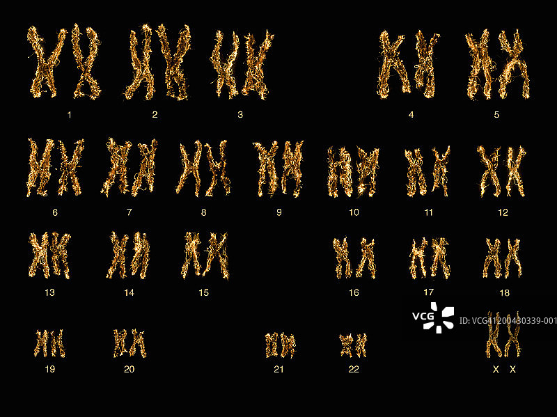 染色体图的图片说明(数码合成)图片素材