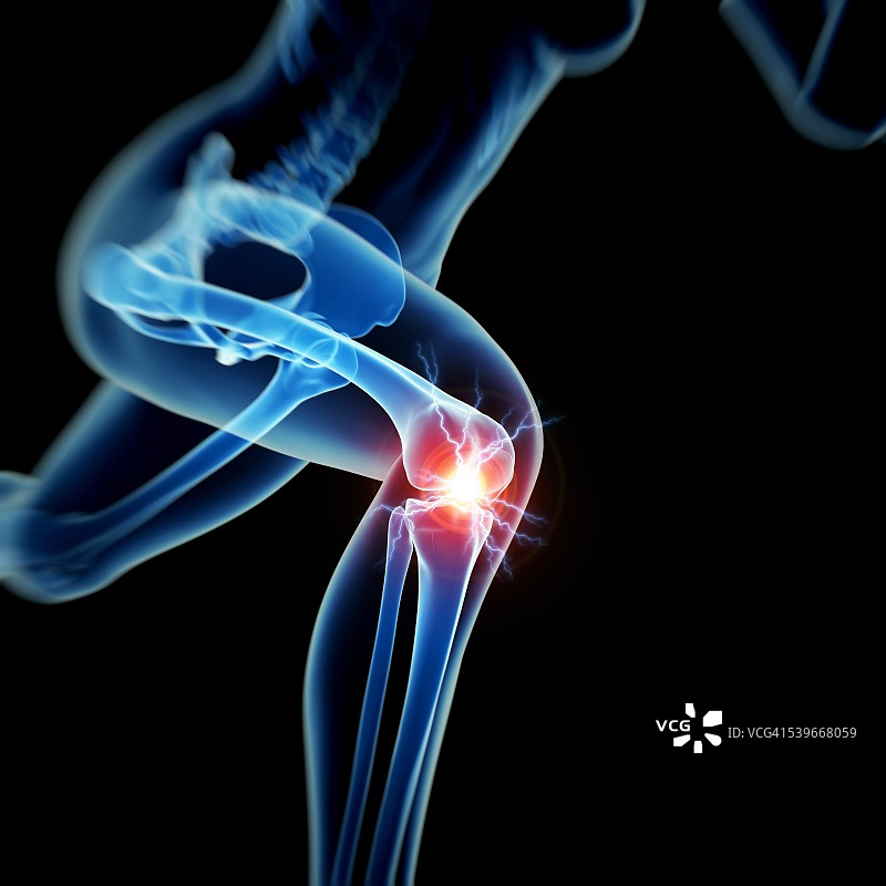 人类膝盖疼痛，插图图片素材