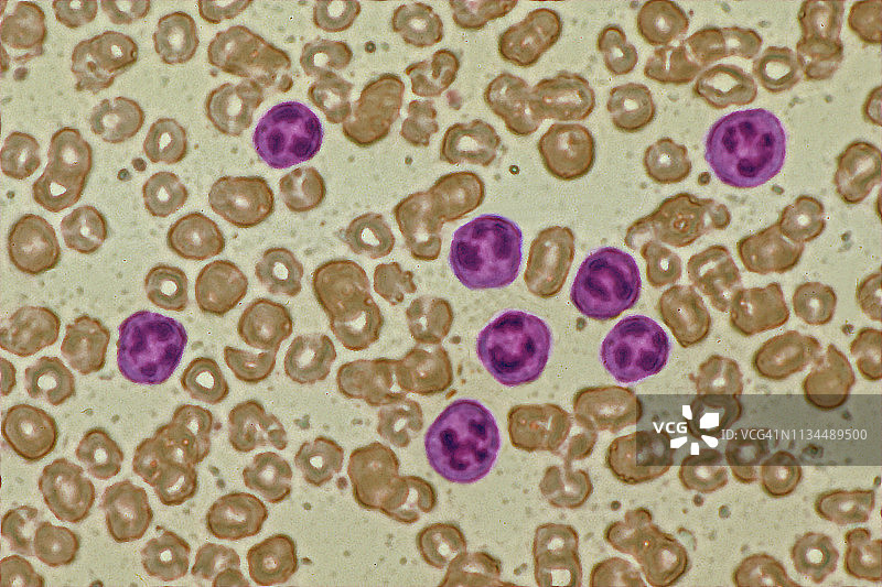 正常人类血细胞的光显微镜照片图片素材
