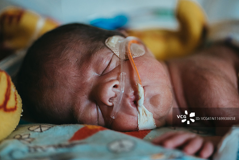 早产儿睡在新生儿重症监护室，有氧气管和喂食管图片素材
