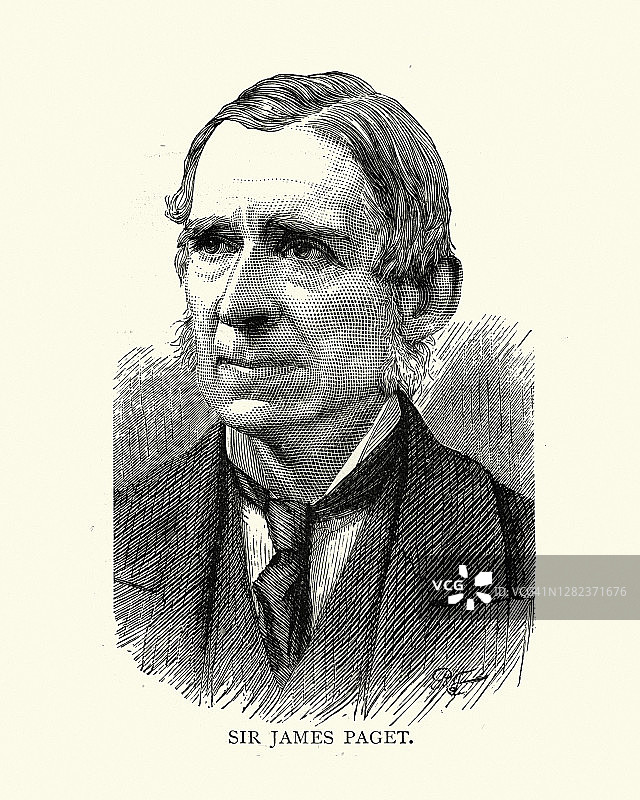 詹姆斯·佩吉特爵士，维多利亚时期的英国外科医生和病理学家图片素材