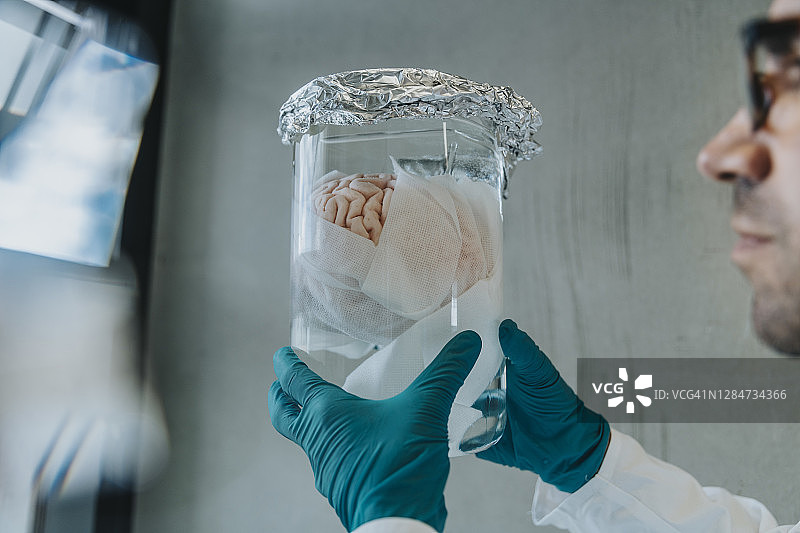 科学家手持保存的人脑烧杯站在诊所走廊上图片素材
