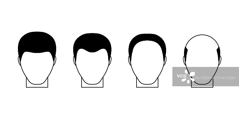 男性阶段为秃顶、秃顶。男性脱发问题。头发下降。矢量平面图图片素材