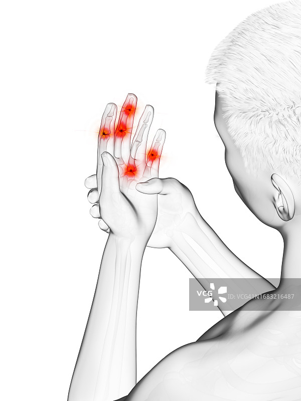 手指关节疼痛，图示图片素材