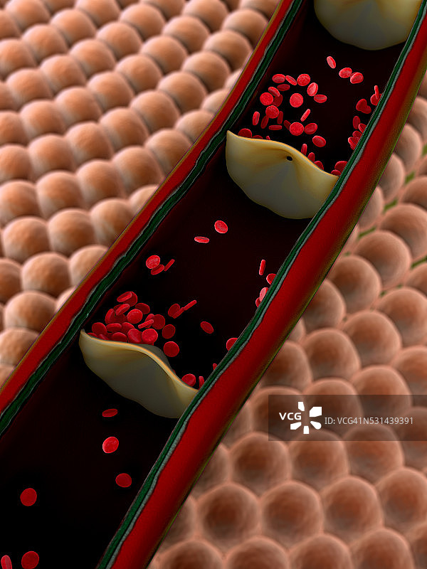 动脉,红细胞图片素材