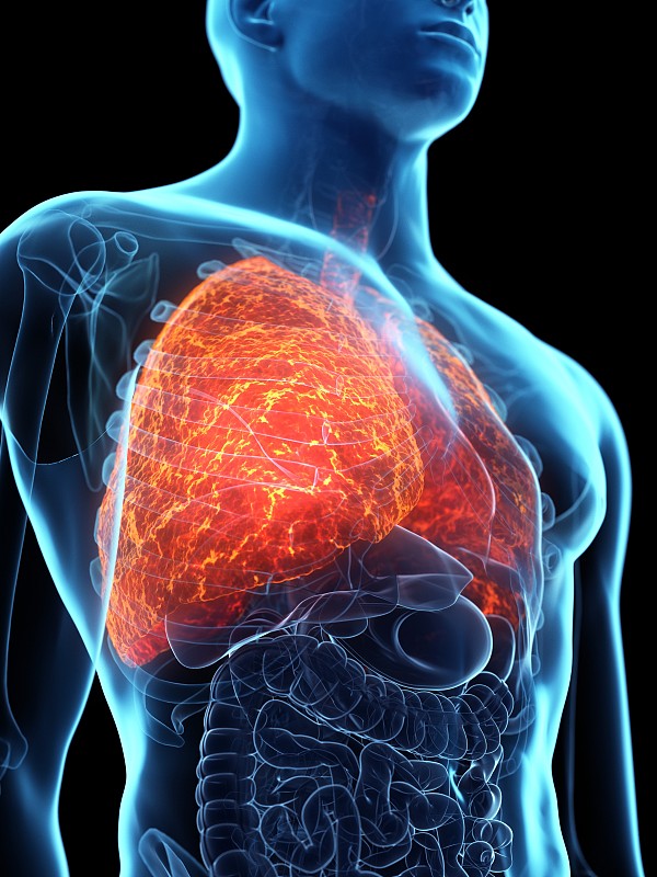 患病的肺，概念说明图片素材