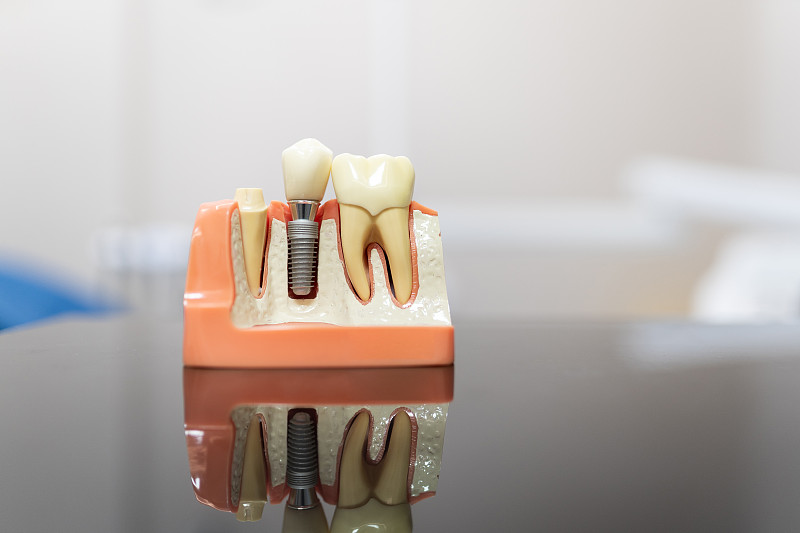 口腔医院牙科诊所牙齿模型图片下载