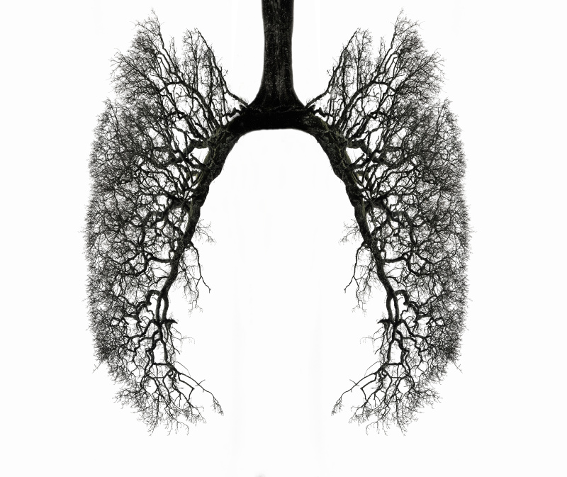 冬天树的树枝呈人肺的形状图片下载