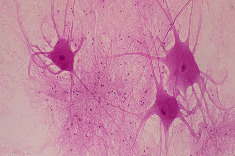脊髓中的神经元或神经细胞-运动神经元显示细胞体(躯体，单一)和轴突，50X图片素材