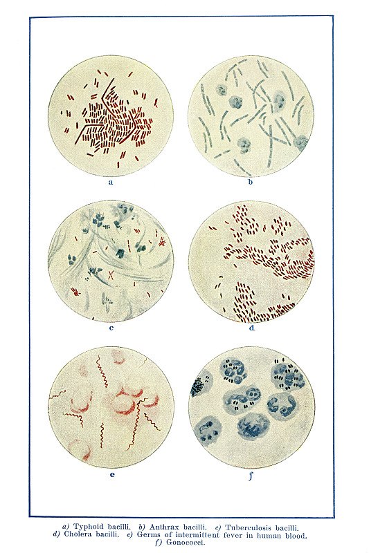 球菌模式图手绘图片
