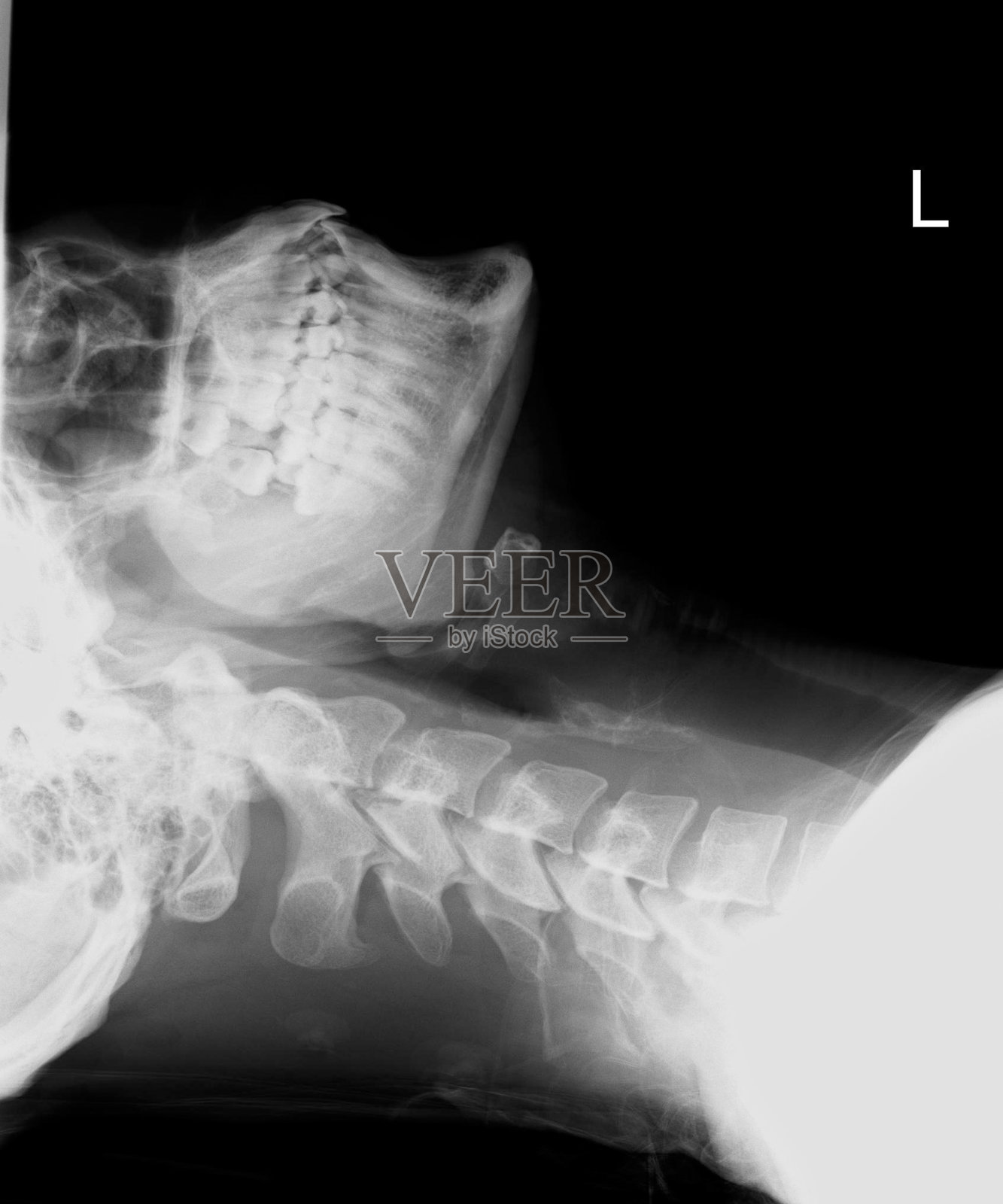 颈部x射线照片摄影图片