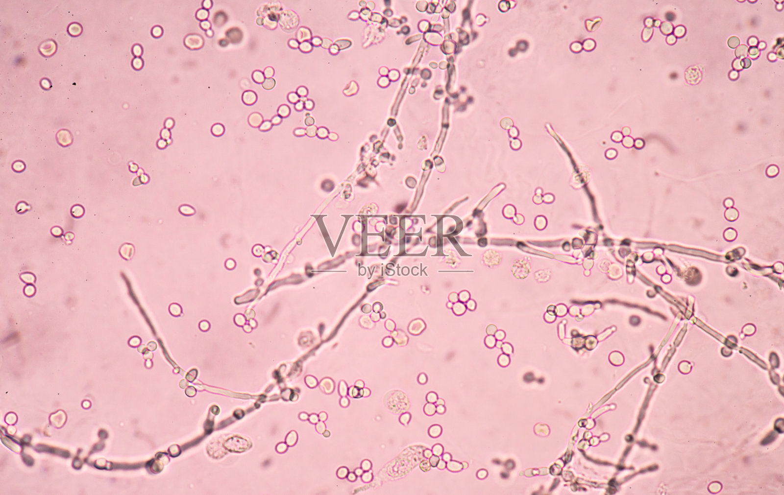 尿中的假菌丝和芽殖酵母细胞照片摄影图片_ID:316385150-Veer图库