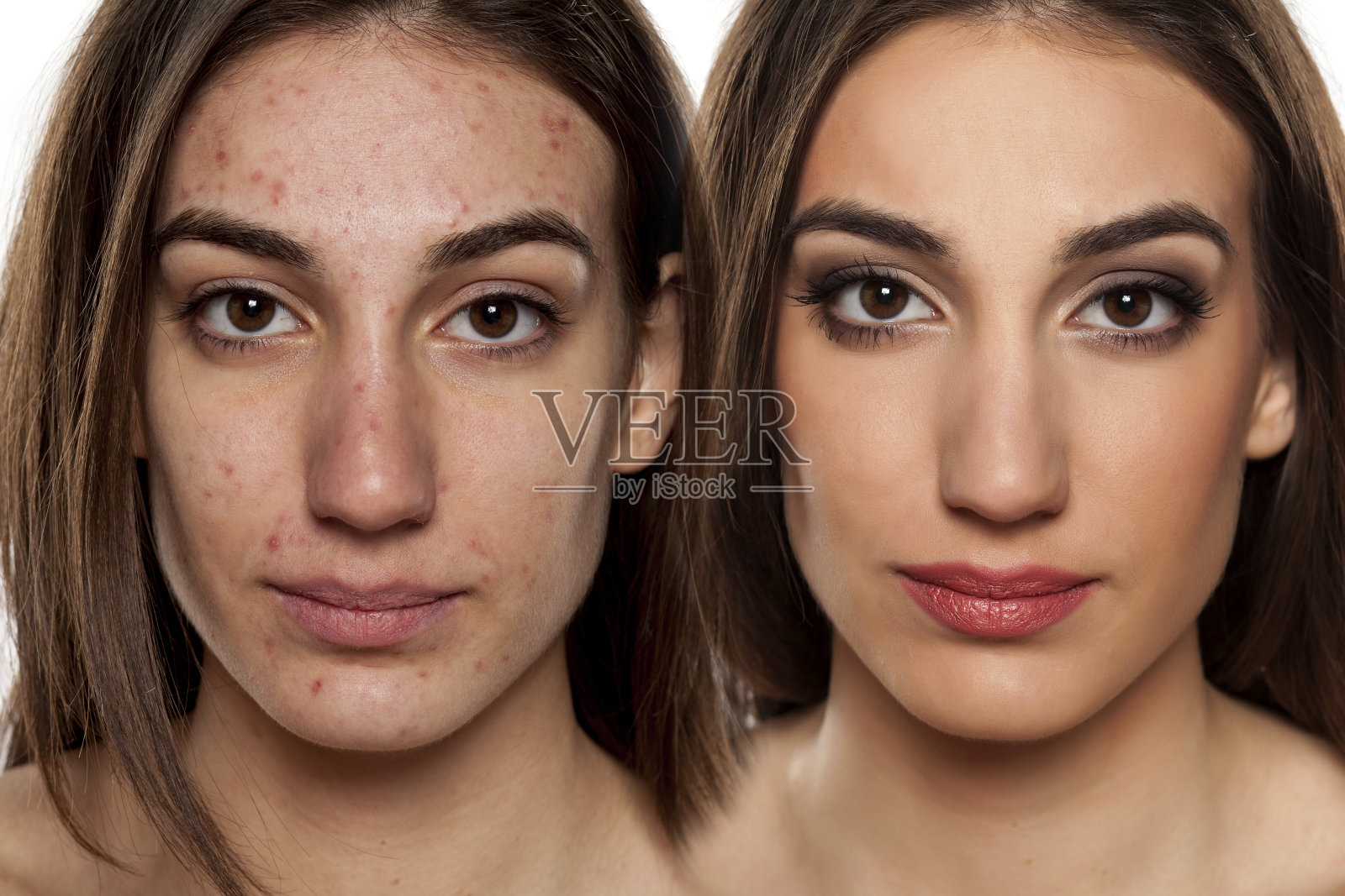 化妆前后皮肤问题照片摄影图片