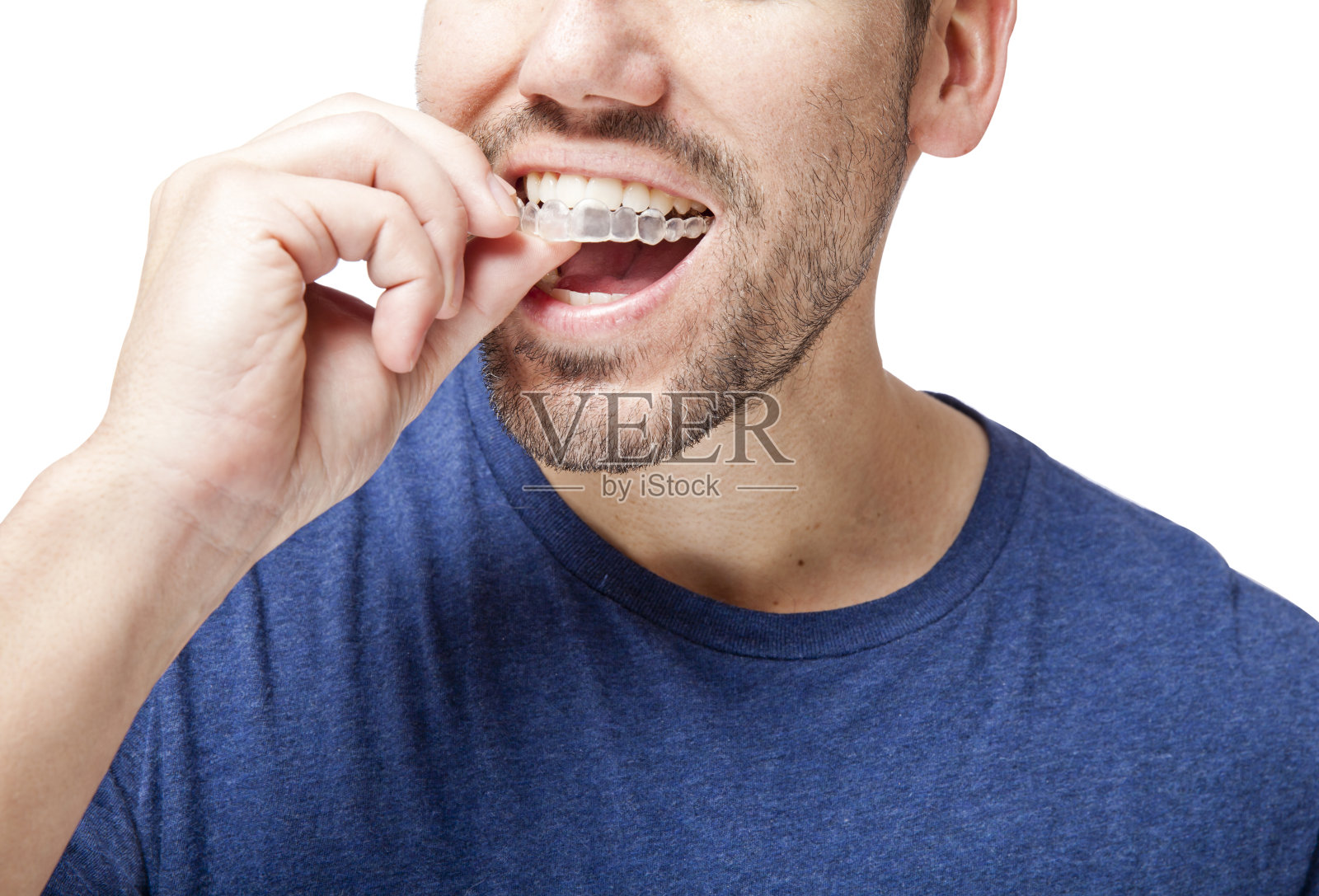 清晰的牙套的人照片摄影图片