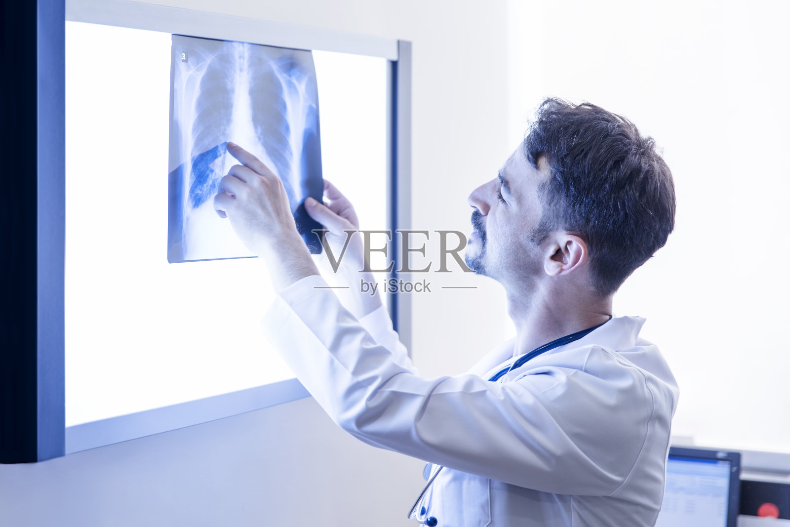 医生在看肺的x光片照片摄影图片