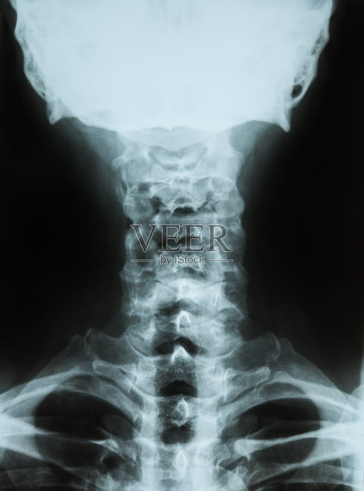 老年男性患者颈椎x光片照片摄影图片