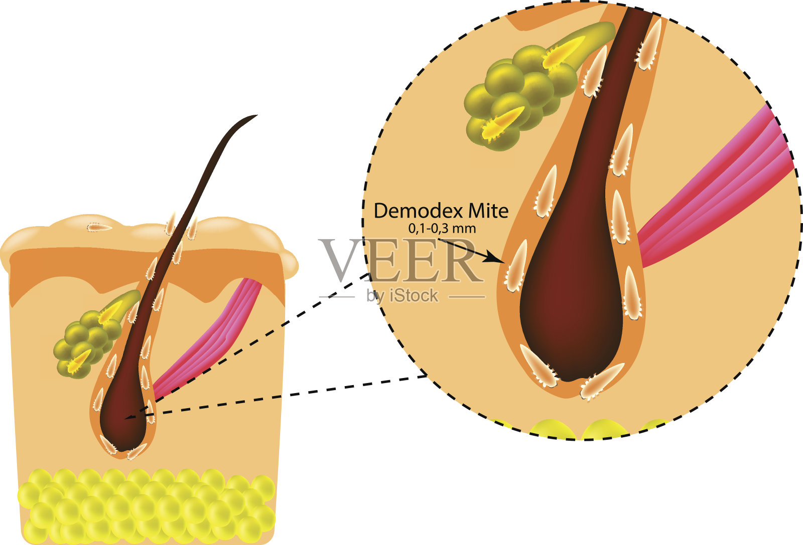 头发的结构。皮脂腺。蠕形螨的介绍。Demodecosis。信息图。矢量插图在孤立的背景插画图片素材