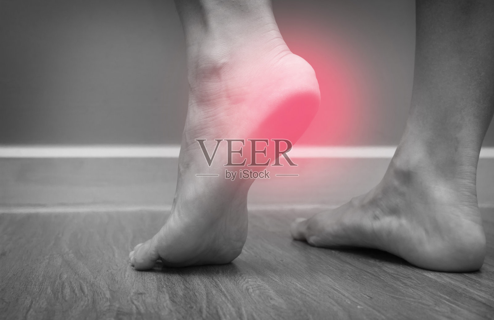 一个女性脚后跟疼痛红斑，足底筋膜炎的特写照片摄影图片