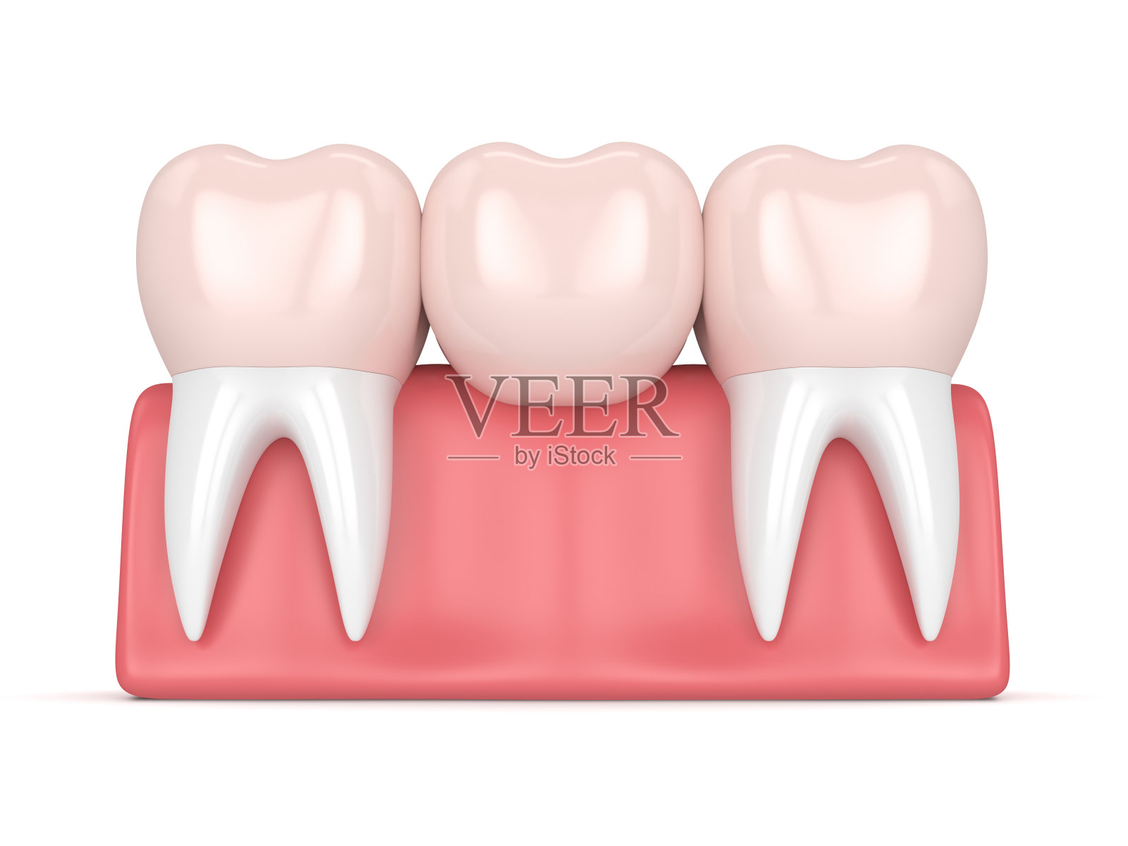 根管治疗和种植牙如何选择牙套？五种牙冠材料的详细分析 - 知乎