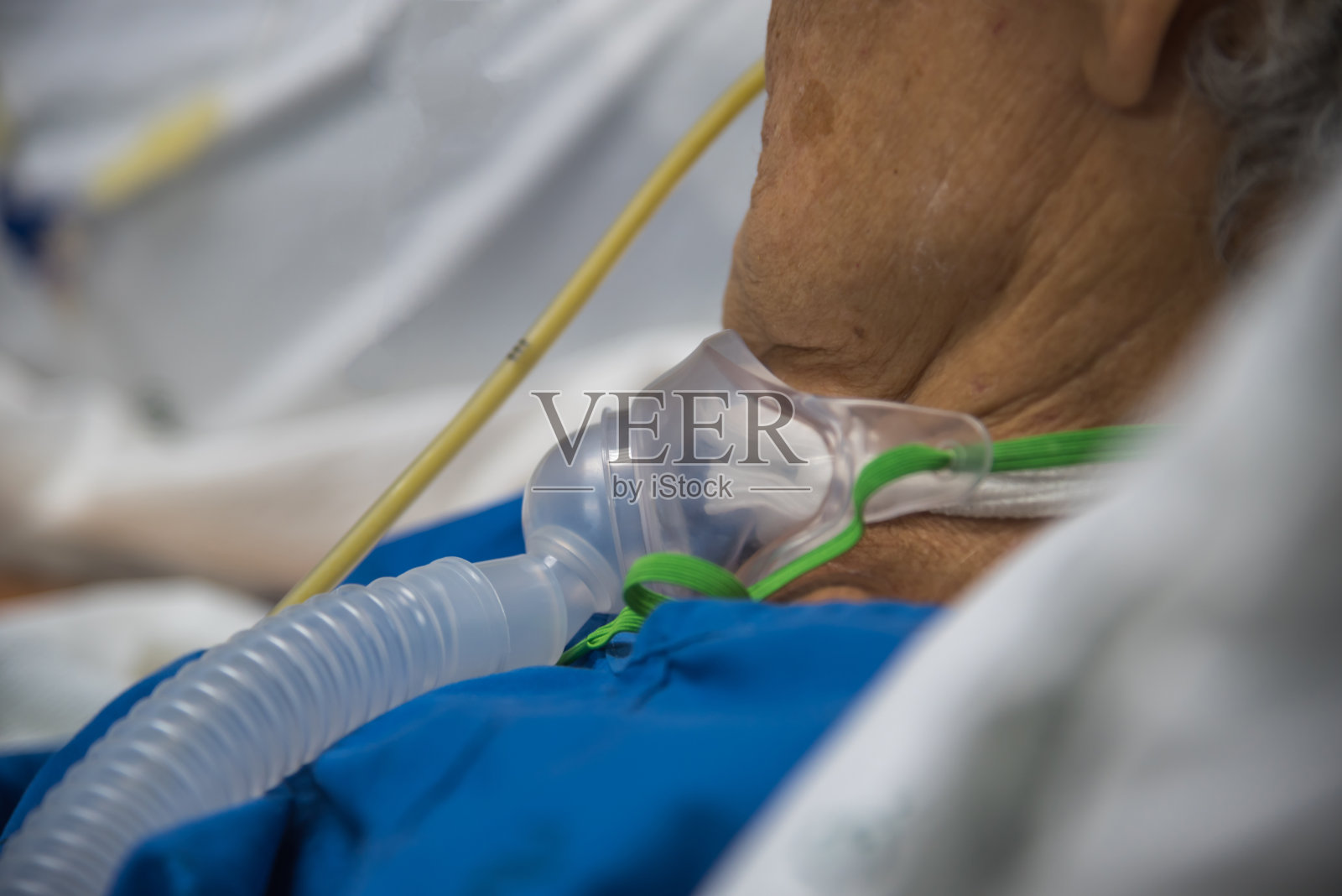 患者为80岁以上的亚洲老年妇女，在医院床上用呼吸机做气管切开帮助呼吸。照片摄影图片