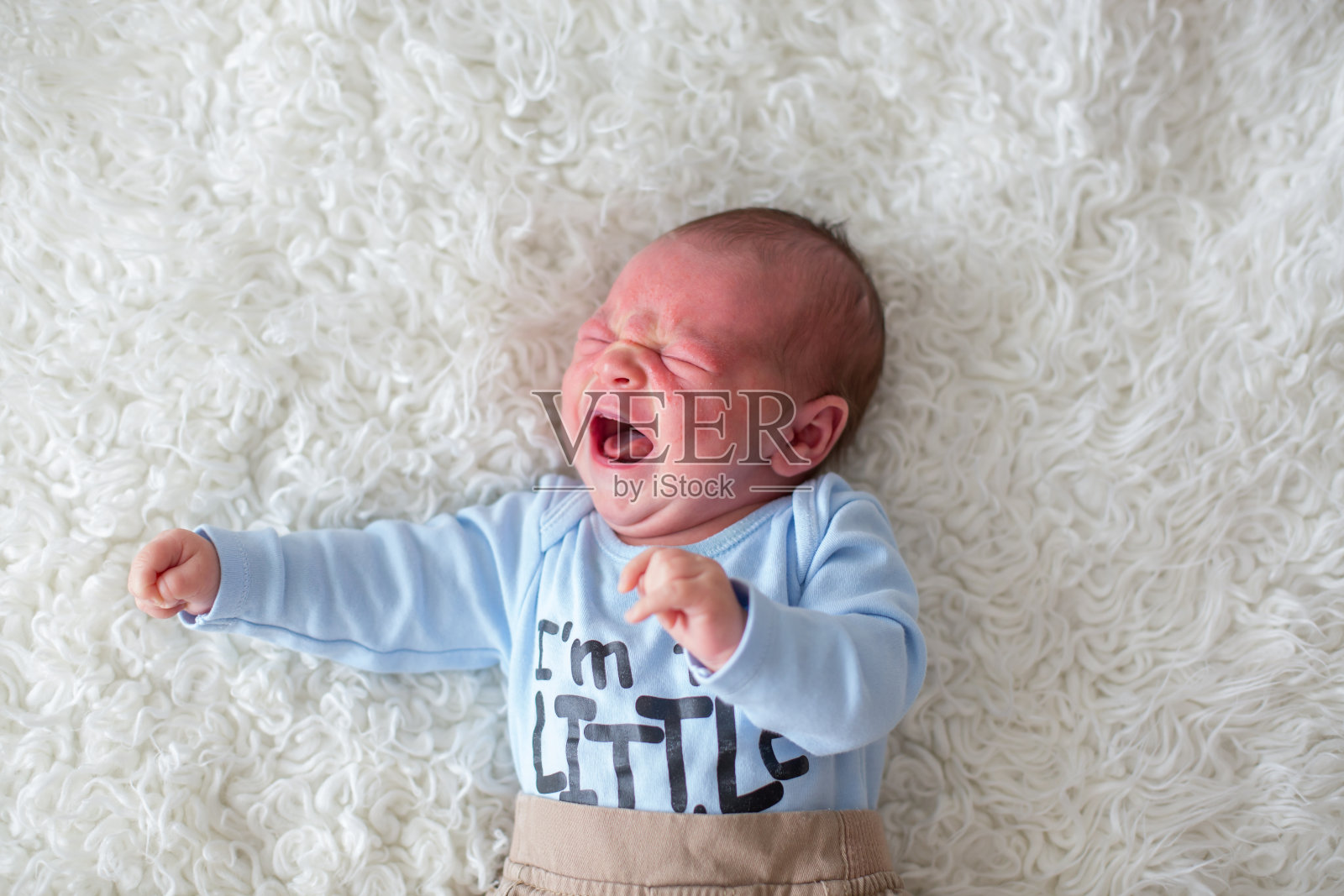 小新生儿哭闹，宝宝有皮疹照片摄影图片