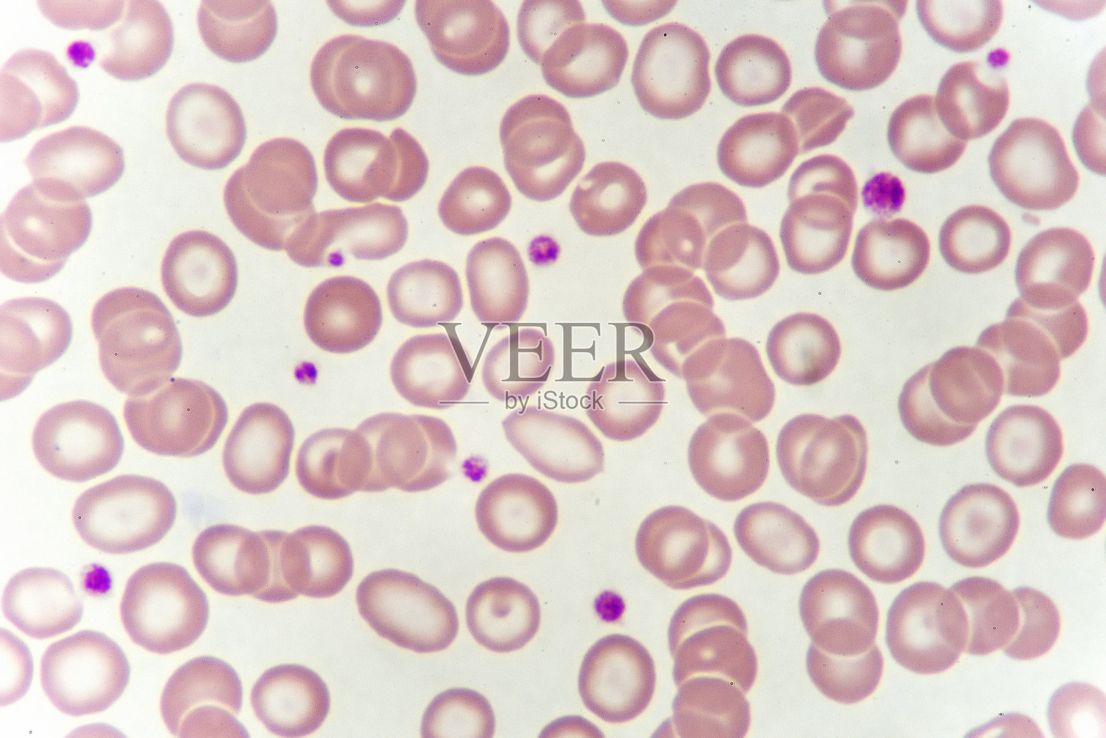 针对异常红细胞的细胞照片摄影图片
