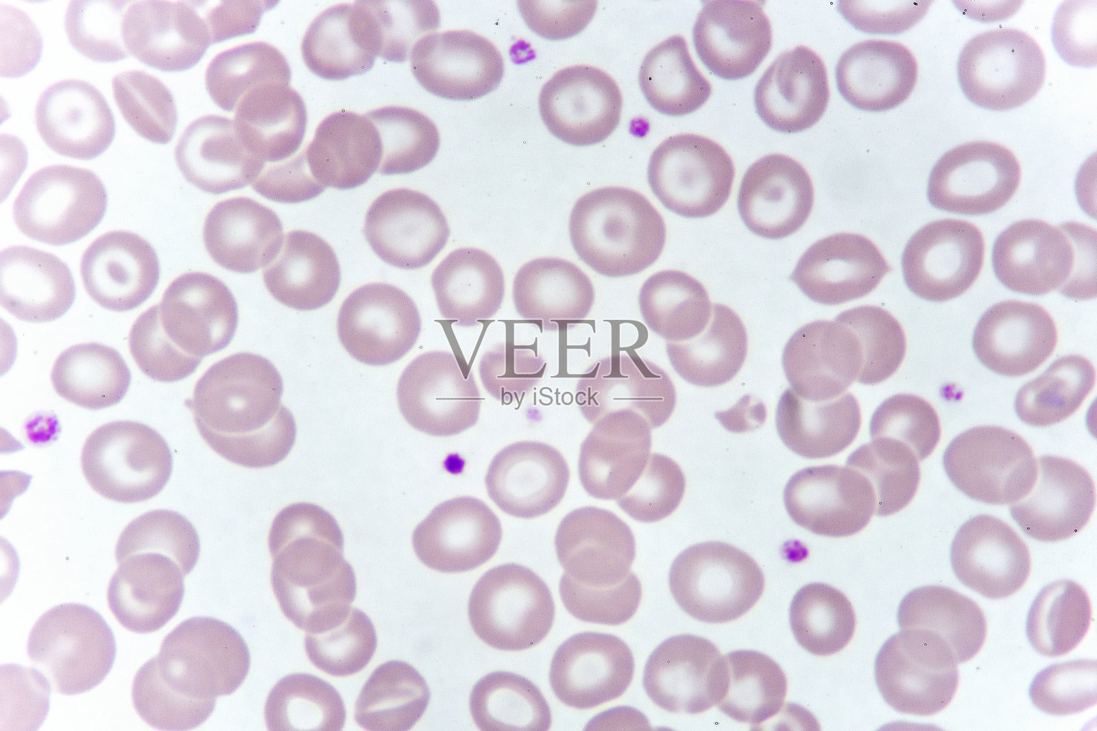 针对异常红细胞的细胞照片摄影图片