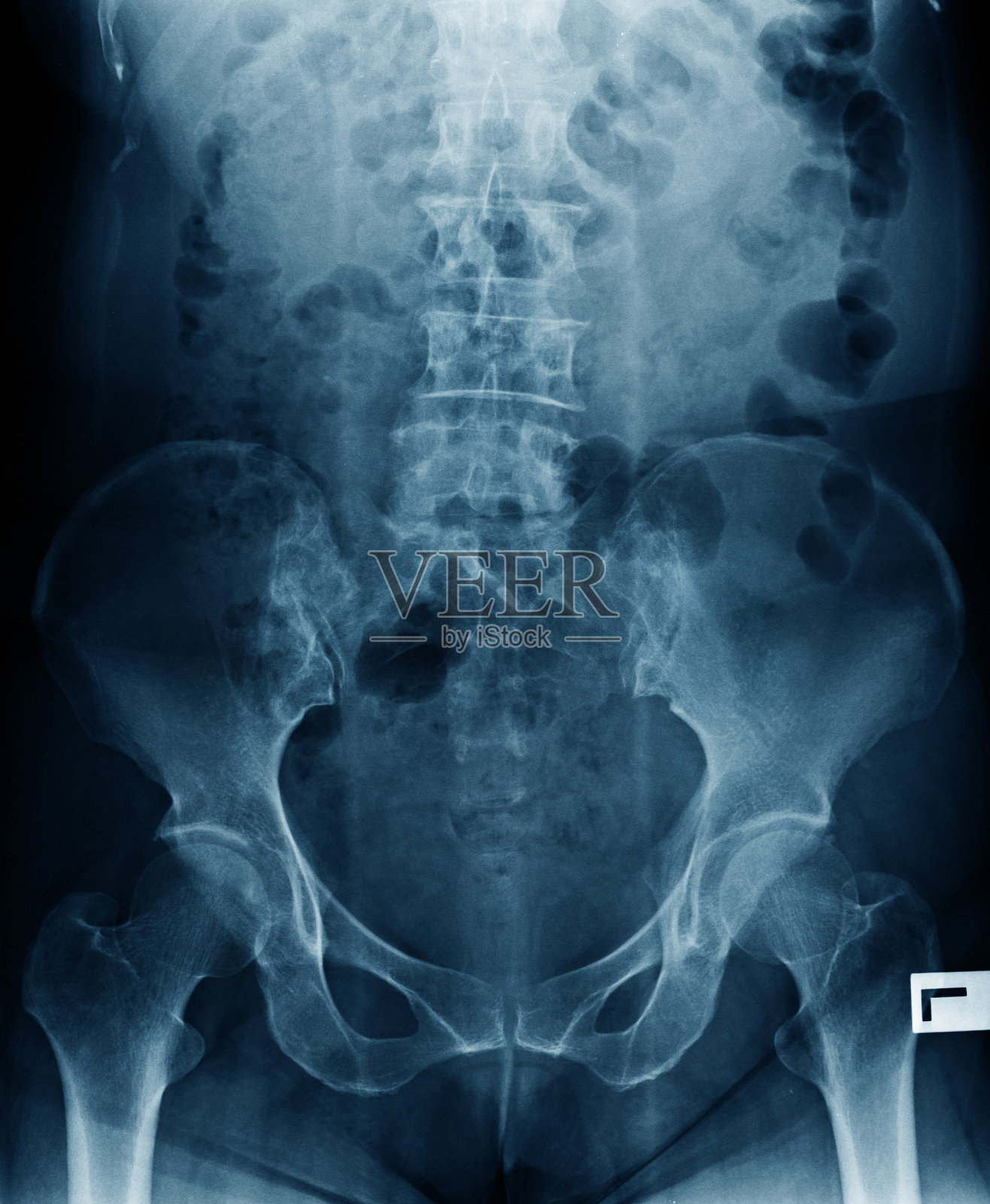 腰椎x光照片摄影图片